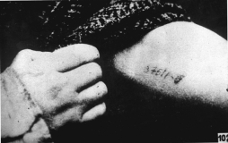Brazo tatuado de un superviviente de los campos. Fuente: Yad Vashem